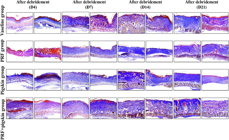 Figure 4