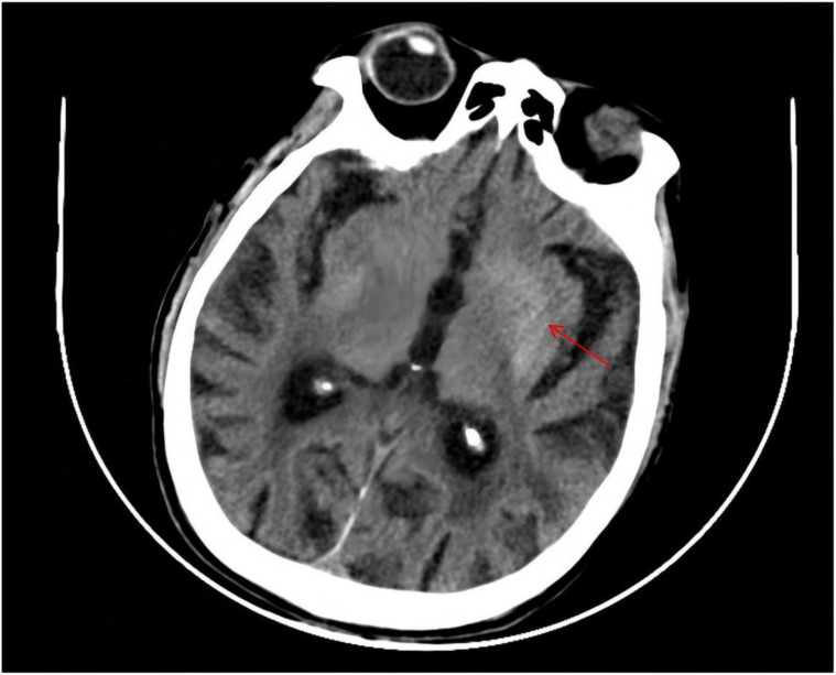Figure 1
