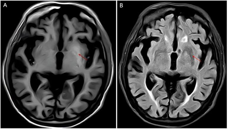 Figure 2