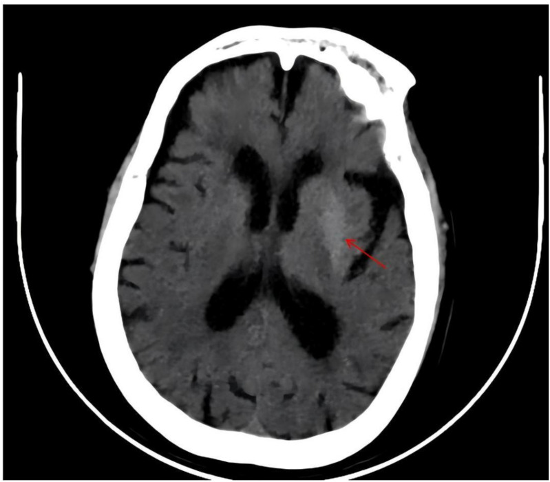 Figure 3