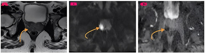Figure 3