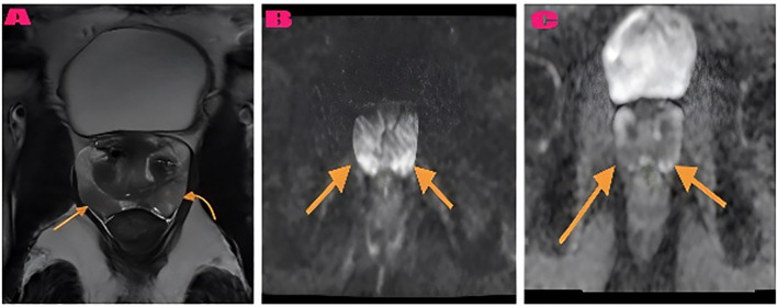 Figure 4