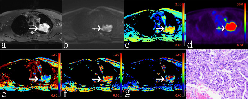 Figure 1