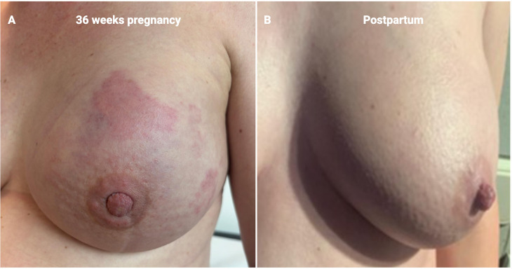 Figure 2