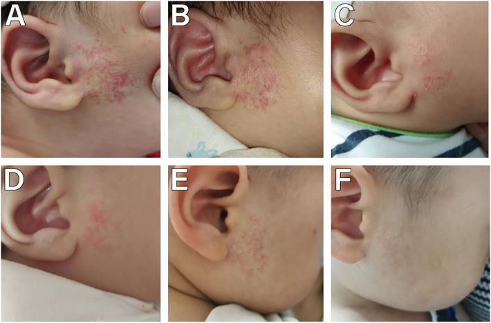 Figure 2