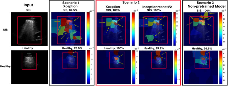 Figure 13