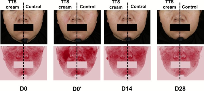 FIGURE 4
