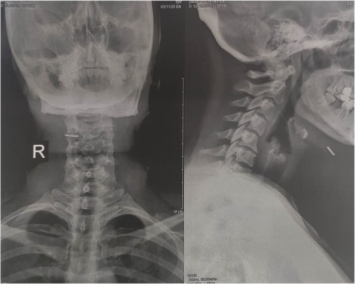 FIGURE 1