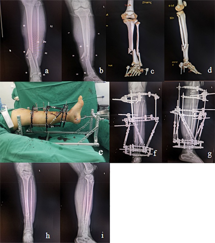 FIGURE 4