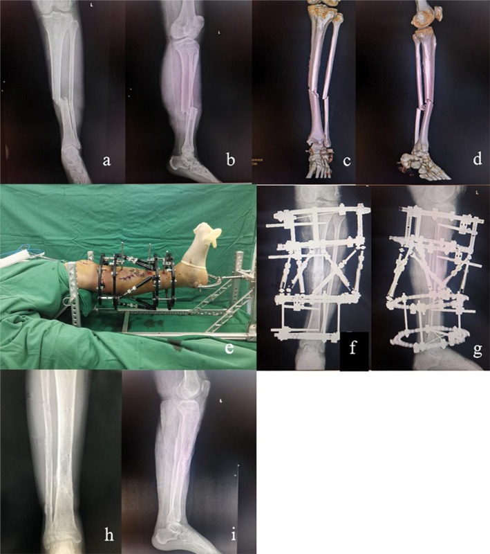 FIGURE 3