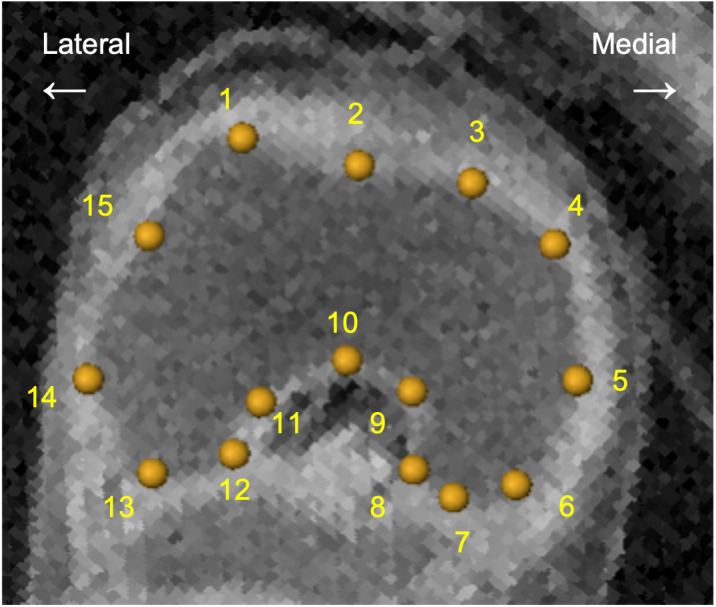 Fig 2