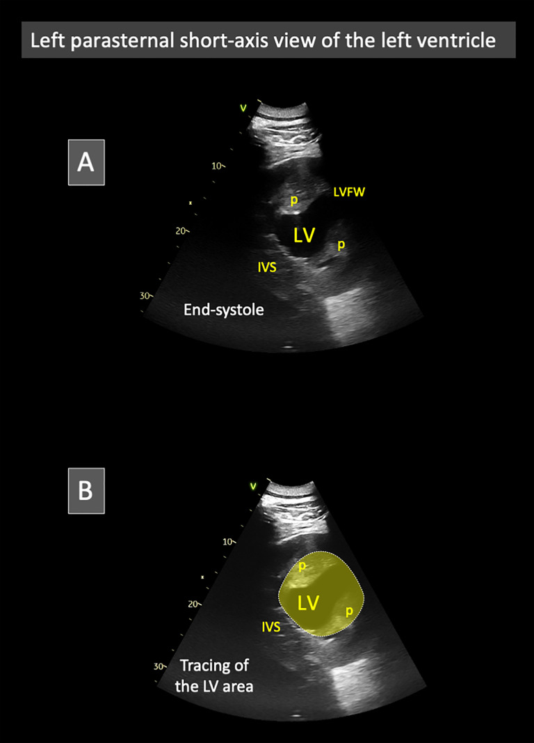 Fig 4