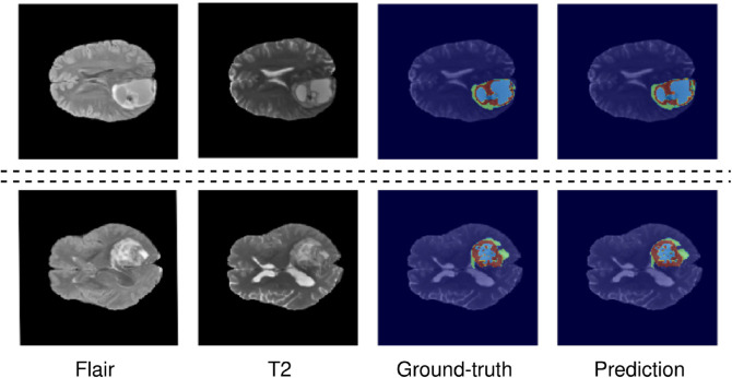 Fig 11
