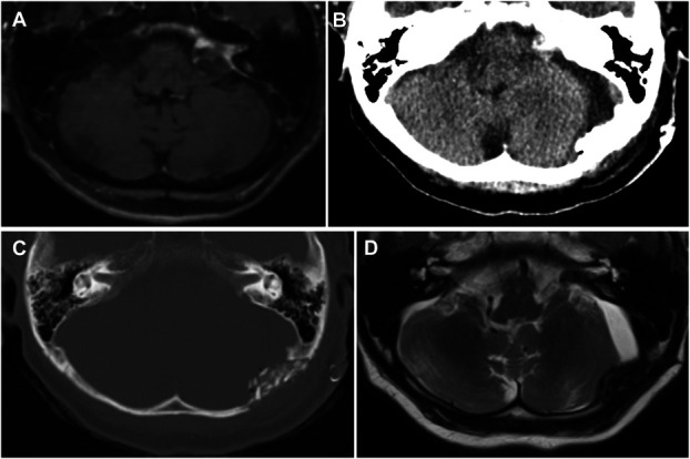 FIGURE 3