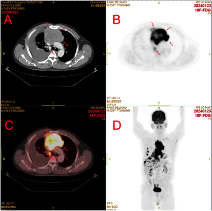 FIGURE 1