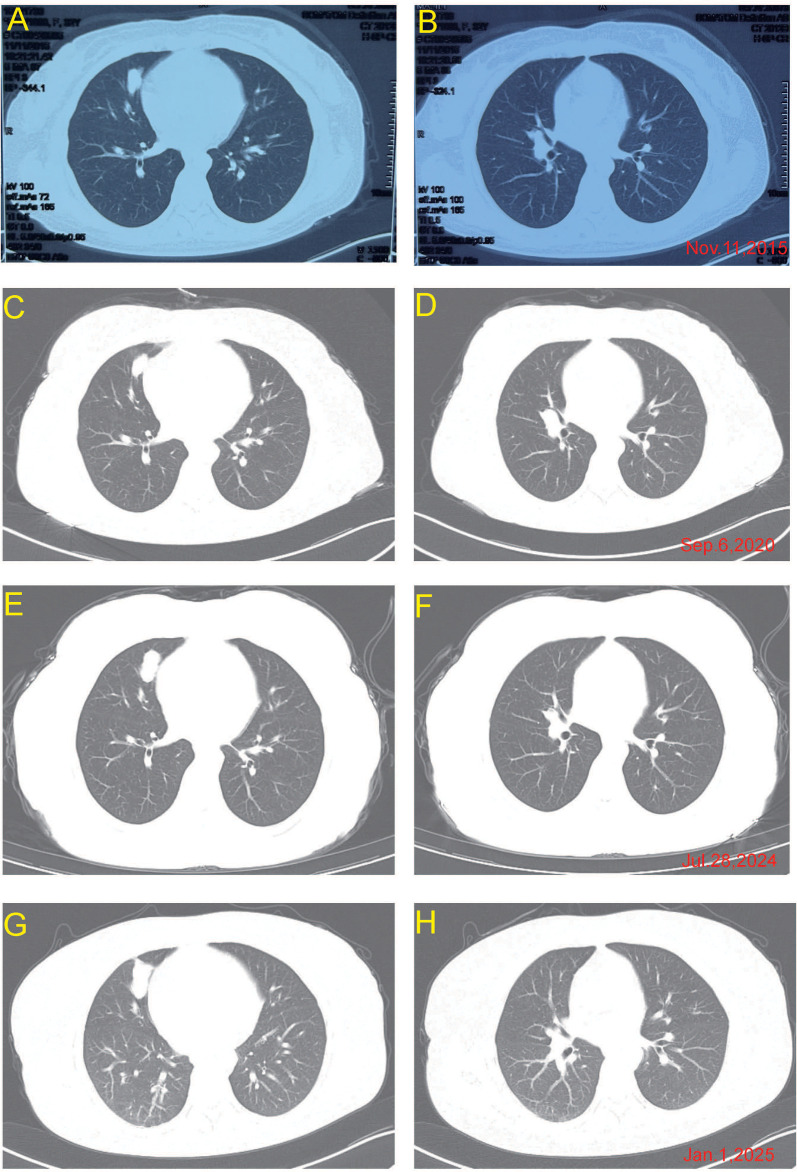 Figure 2