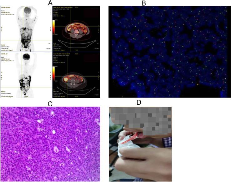 Figure 2