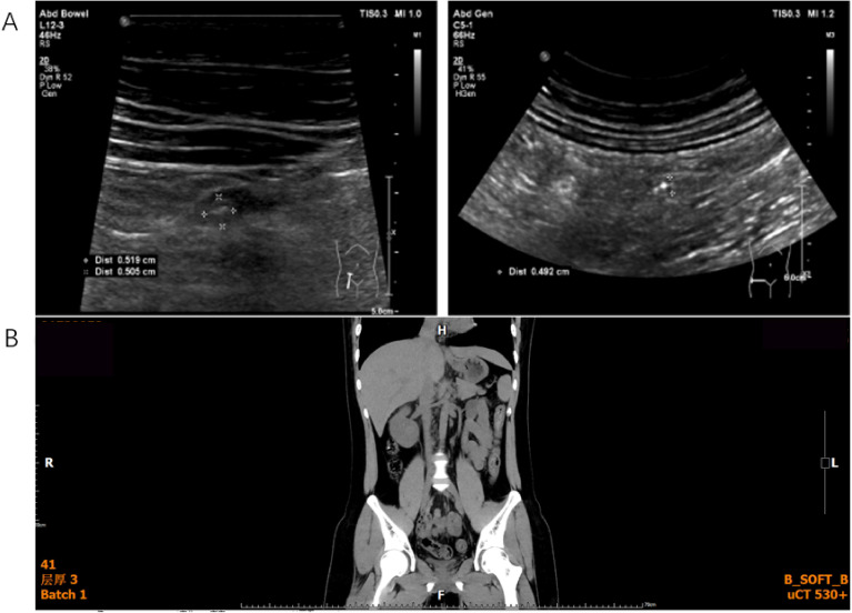 Figure 4