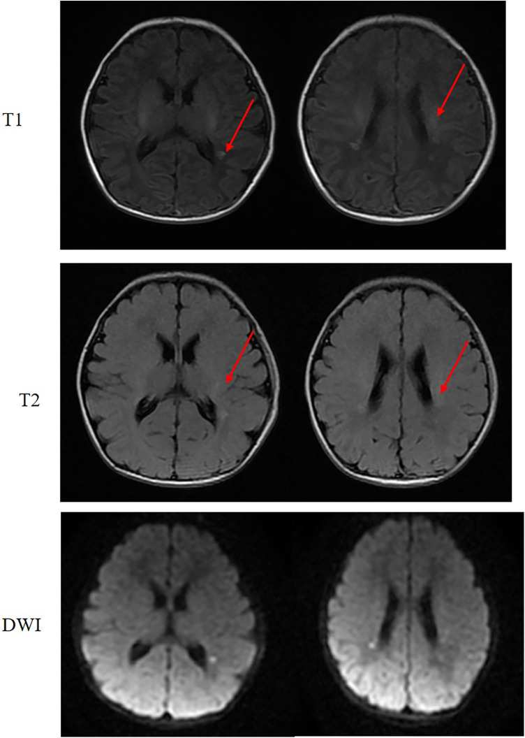 Figure 2