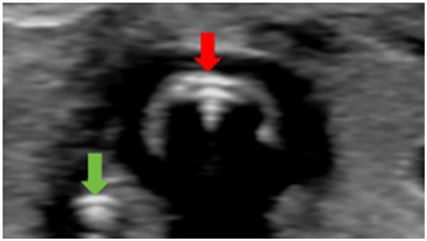 Figure 3