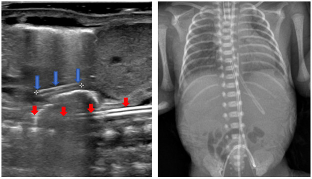 Figure 4
