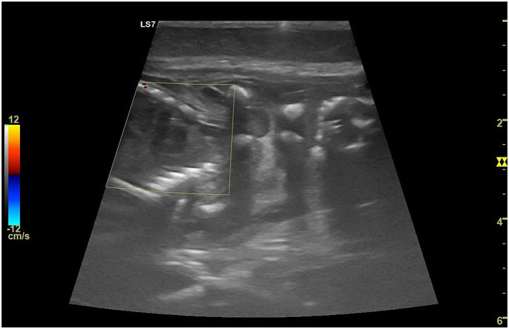 Figure 10