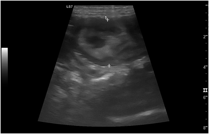 Figure 11