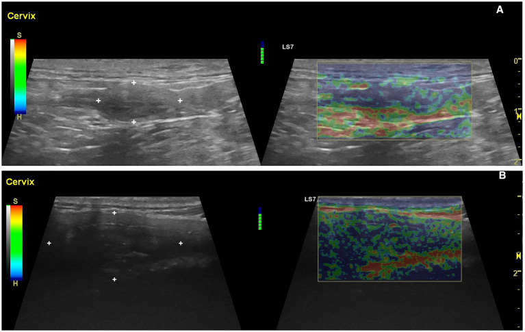 Figure 14