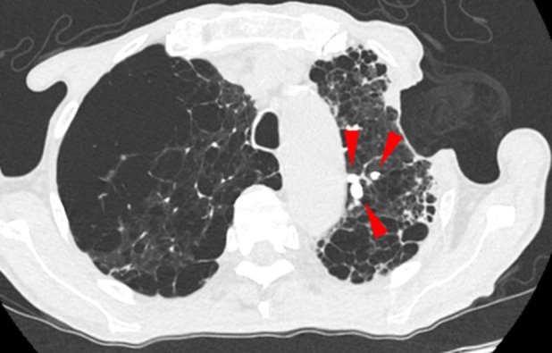 FIGURE 3