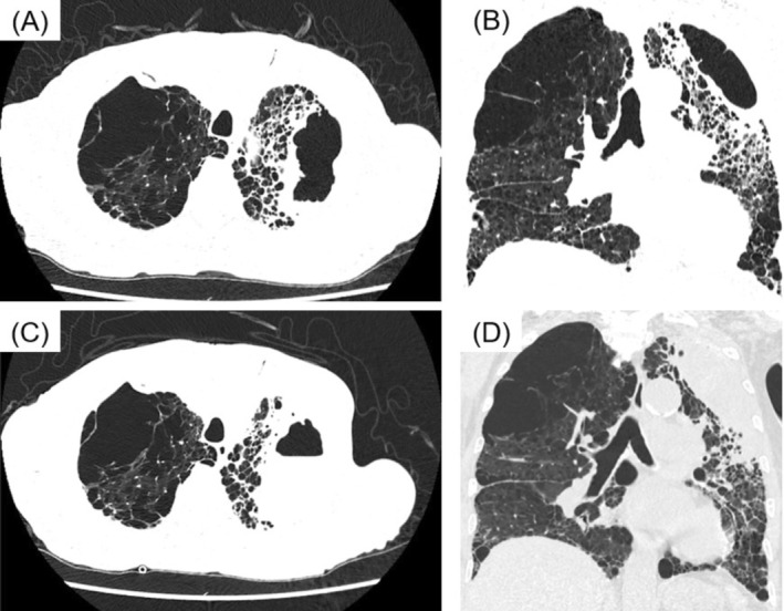 FIGURE 1