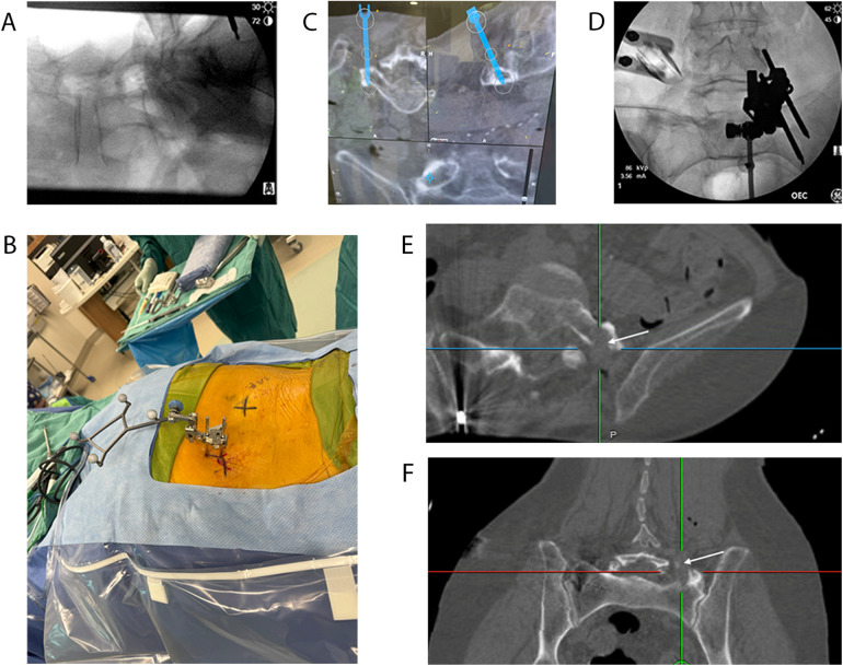 Figure 3