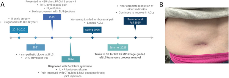 Figure 4