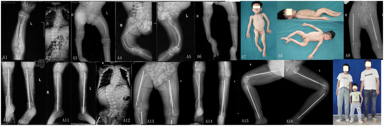 Figure 1