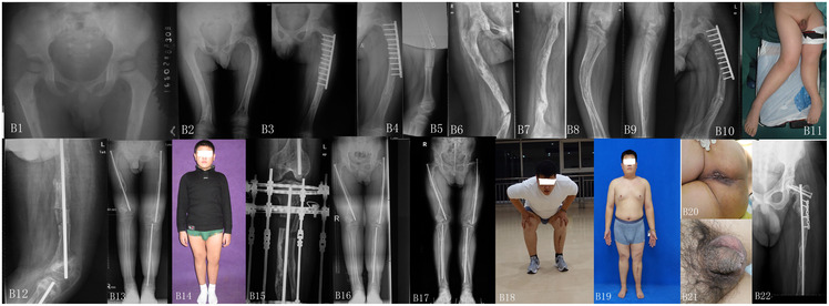 Figure 2