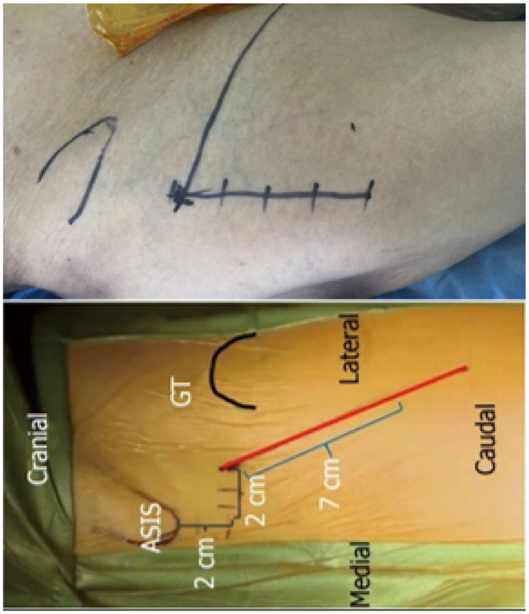 Figure 1