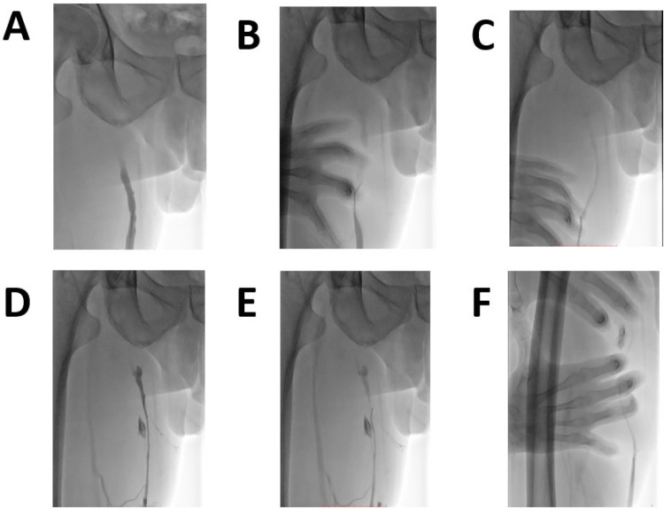 Figure 1