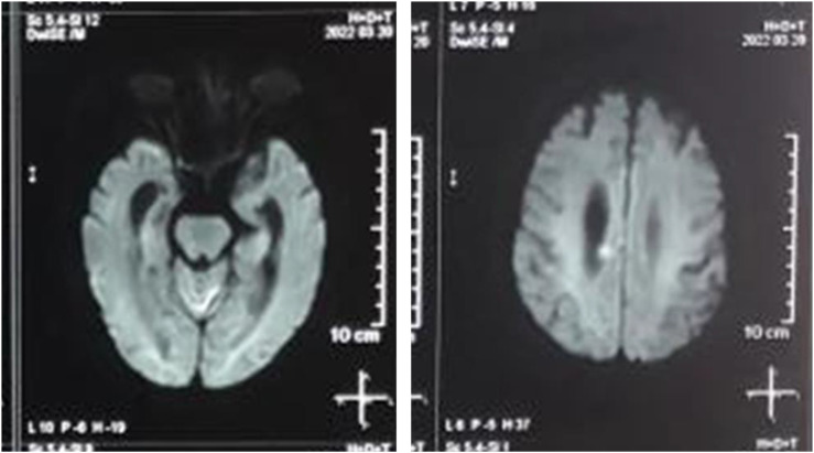 Figure 3