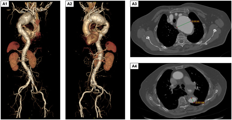 Figure 1