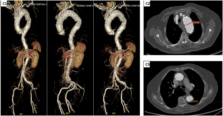 Figure 3