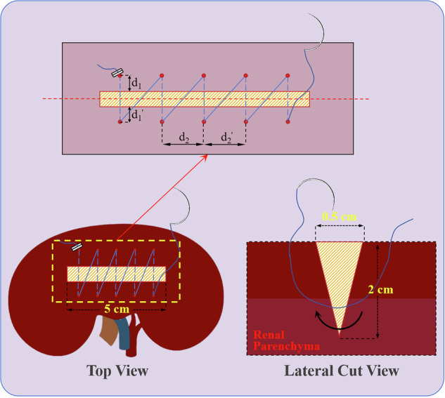 Figure 17
