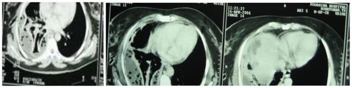 FIGURE 2, 3, 4