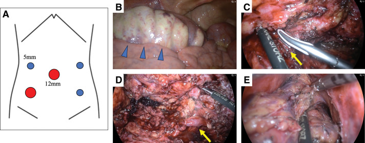 Fig. 4