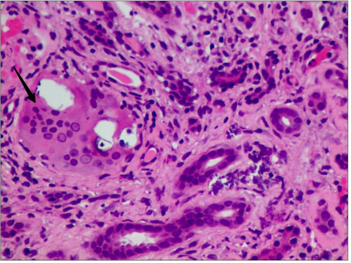 Figure 1