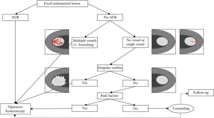 Figure 14