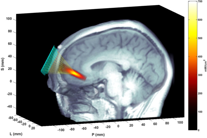 Figure 3