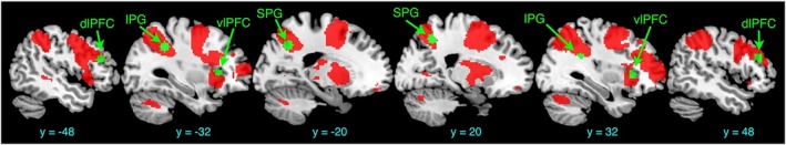 FIGURE 3