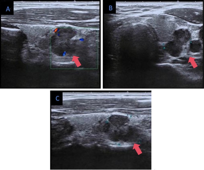 FIGURE 1