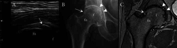 FIGURE 1