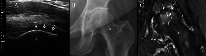 FIGURE 2