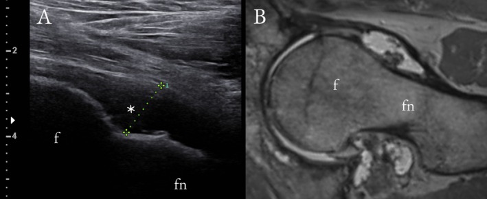 FIGURE 3